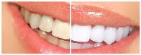 Dentist in Geelong - Around Geelong Dental Care image 11